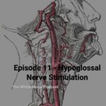 Medical drawing of human neck and nerves